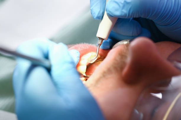 Best Cosmetic Emergency Dentistry in Point Lookout, NY