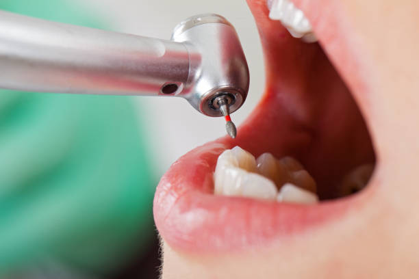 Best Cosmetic Emergency Dentistry in Point Lookout, NY